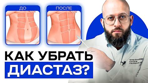 Грибковая диастаза: что это и какие симптомы