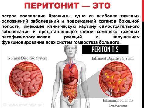 Дерматологические заболевания, приводящие к трещинам