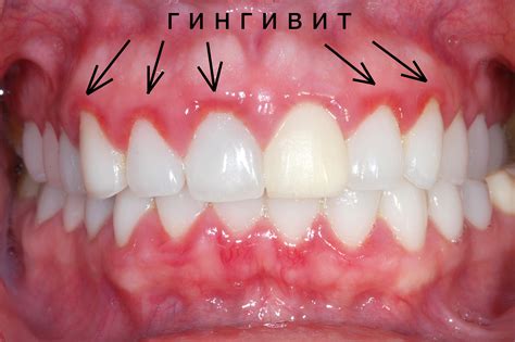 Десна: проблемы и их проявление