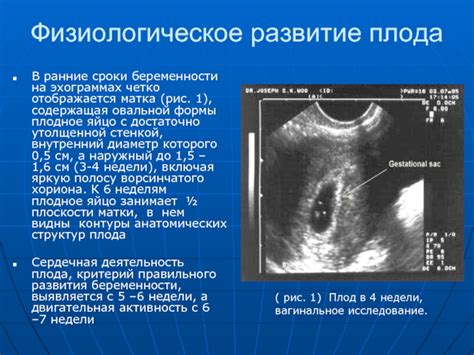 Деформация плодного яйца: что происходит и почему