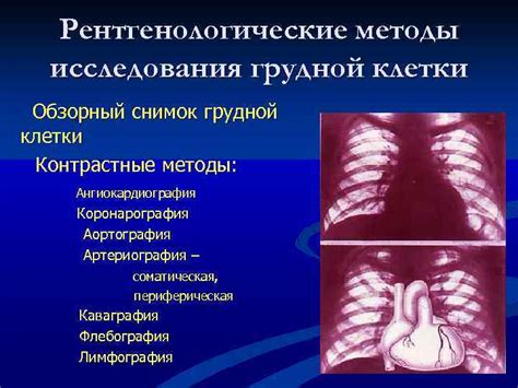 Диагностика СВД кардиологии