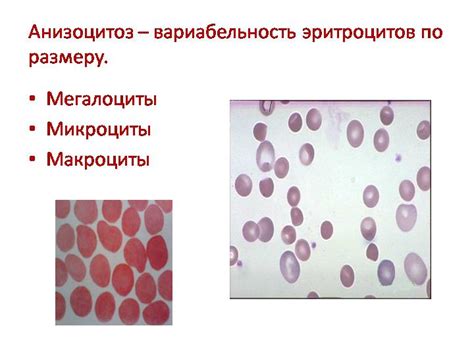 Диагностика анизоцитоза