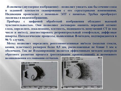 Диагностика водянистых глаз