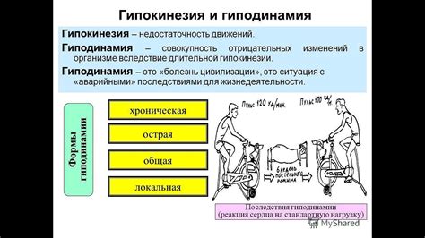 Диагностика гипокинезии