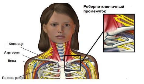 Диагностика защемления мышцы