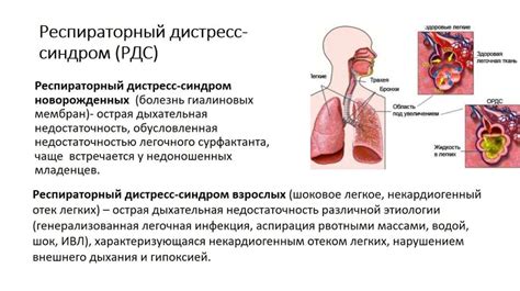 Диагностика инфекции органов дыхания