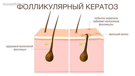 Диагностика и лечение недостаточно выраженного фолликулярного аппарата