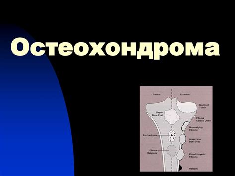 Диагностика и лечение патологий костей бабочки