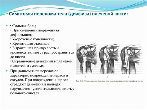 Диагностика и лечение поперечного сужения