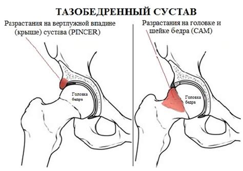 Диагностика и лечение проблем с шейкой сакральной