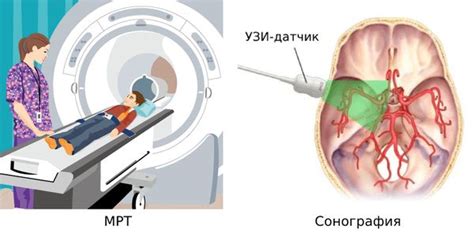 Диагностика кисты черепа