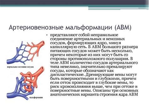 Диагностика нарушений сосудов головного мозга: современные методы и исследования