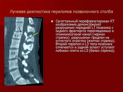 Диагностика нарушения статики позвоночного столба