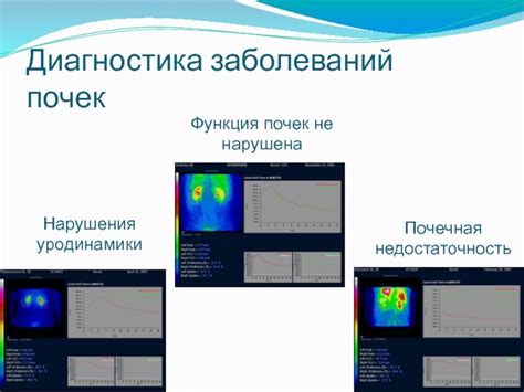 Диагностика нарушения уродинамики почек