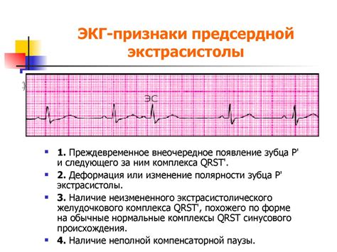 Диагностика неспецифического нарушения ЭКГ