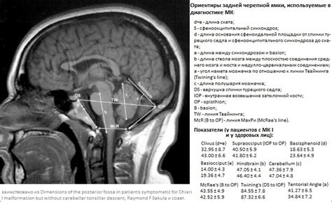 Диагностика низкого стояния миндалин мозжечка