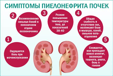 Диагностика обострения пиелонефрита