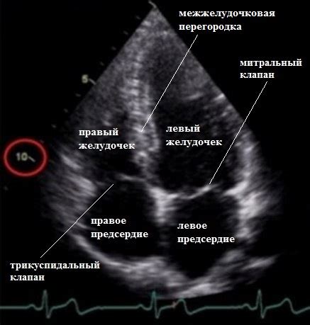 Диагностика отклонения верхушки сердца назад