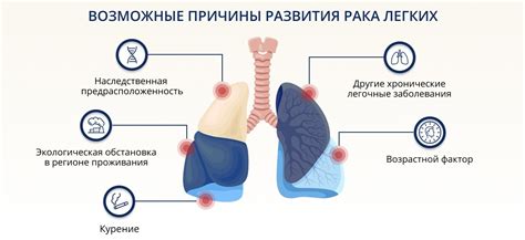 Диагностика отслоения легкого