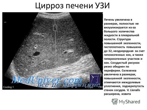 Диагностика повышенной эхогенности печени у взрослых