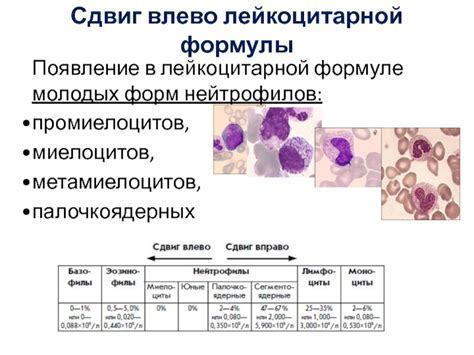 Диагностика повышенных уровней нейтрофилов