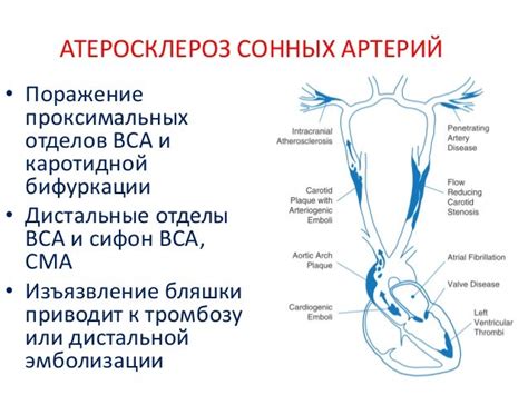 Диагностика стеноза ВСА справа