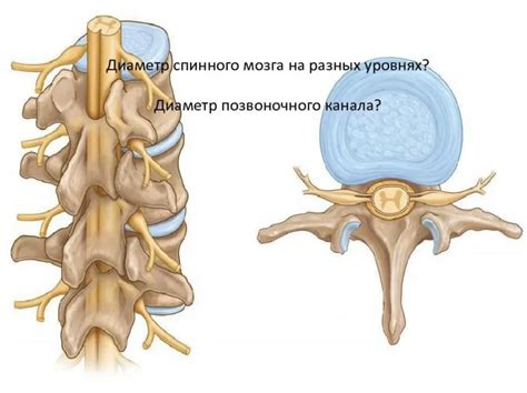 Диагностика сужения позвоночного канала