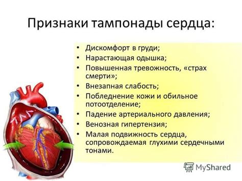 Диагностика тампонады сердца
