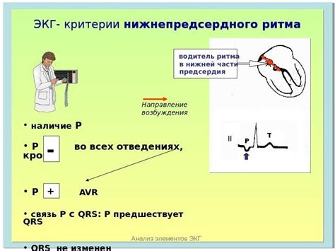 Диагностические методы выявления нижнепредсердного ритма