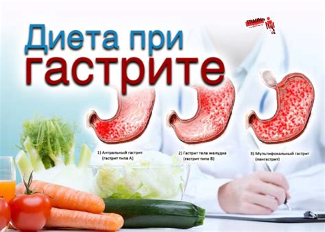 Диета при гастрите второй степени