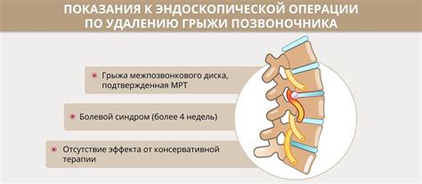 Дорзальная диффузная протрузия межпозвонкового диска