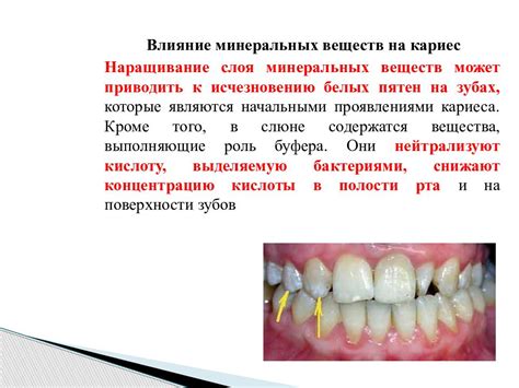 Жидкость в ротовой полости и ее влияние на речь: как справиться с проблемой