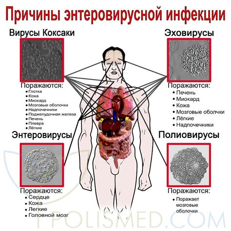 Заболевание и симптомы