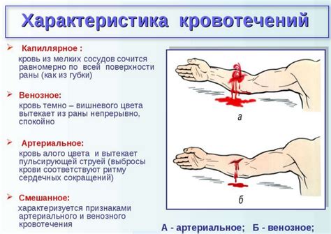 Заболевания, вызывающие кровотечение