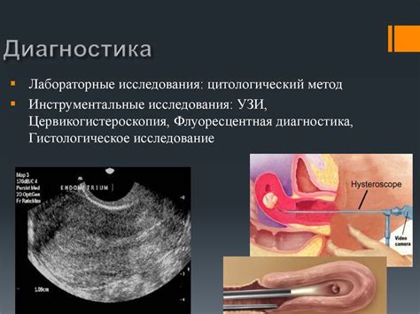 Заболевания половой сферы