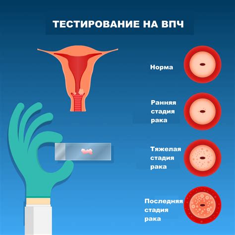 Затруднения с визуализацией шейки матки