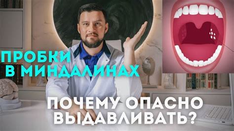 Зачем очищать миндалины и как это сделать