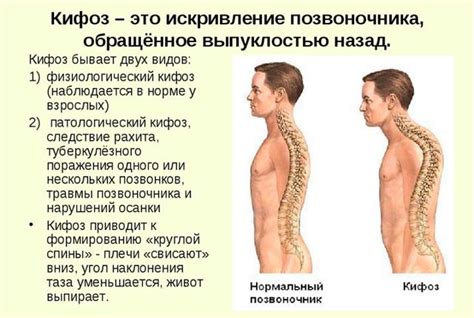 Здоровье позвоночника: ротация тел позвонков