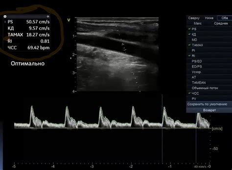Значение ЧСС при УЗИ