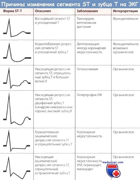 Значение ЭКГ (электрокардиограммы) у подростков