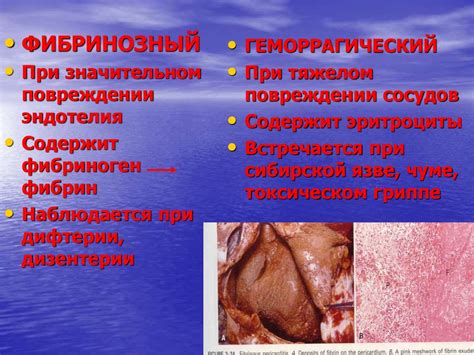 Значение гнойного воспаления иллюстрирует видение нарыва в сновидении