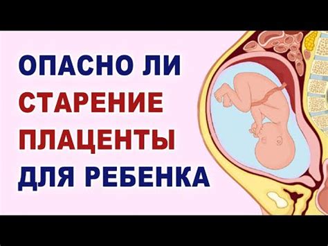 Значение зрелости плаценты для беременности