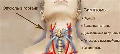 Значение кадыка у девушек и его влияние на самочувствие и здоровье