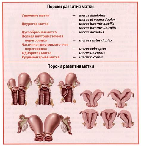 Значение локализации хориона на задней стенке матки