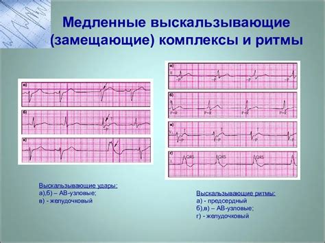 Значение положения ЭОС в синусовом ритме