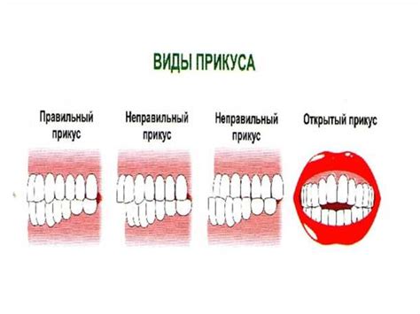 Значение прикуса щеки для речи и пищеварения