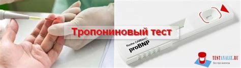 Значение тропонинового теста