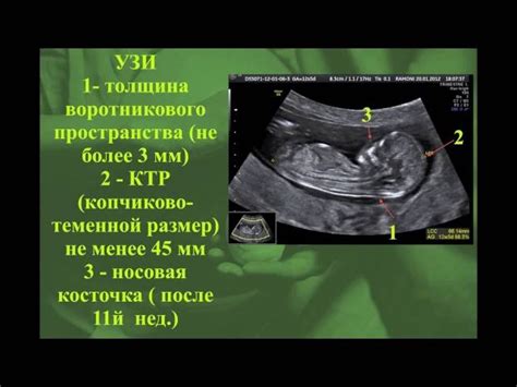 Значение уменьшения толщины воротникового пространства