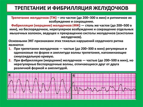 Значение усиления биоэлектрической активности левого желудочка