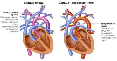 Значение шума сердца у ребенка новорожденного